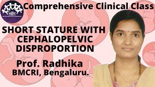 Short Stature with Cephalopelvic Disproportion Case Presentation [upl. by Kravits]