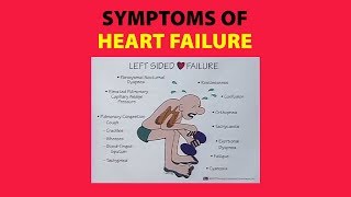 Symptoms of Heart Failure [upl. by Yrral]