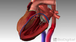 3D Medical Animation  Congestive Heart Failure [upl. by Sidnala793]