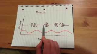 Biots Respiration [upl. by Kafka]