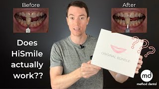 HiSmile Review By A Dentist Dr Grant McGrath [upl. by Bohman]