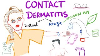 Contact Dermatitis [upl. by Ire]