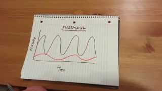 Kussmaul Respiration [upl. by Pudendas]