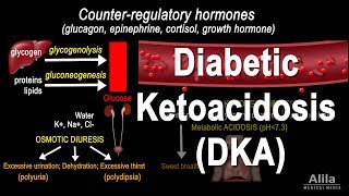 Diabetic Ketoacidosis DKA Pathophysiology Animation [upl. by Bax518]